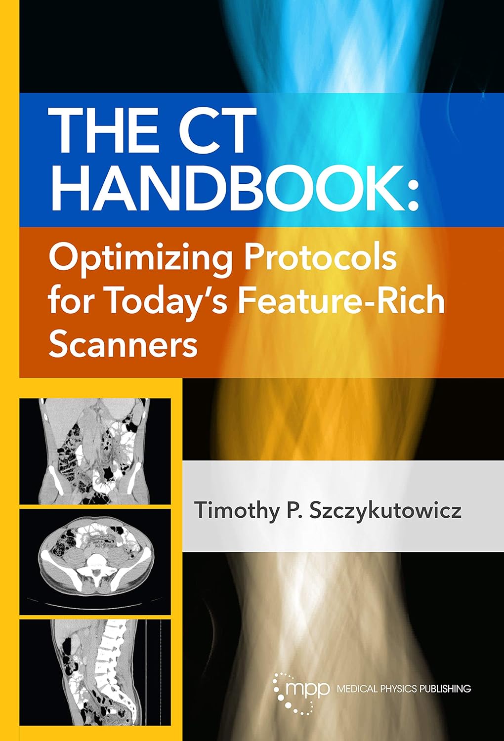 The CT Handbook: Optimizing Protocols for Today's Feature-Rich Scanners (Original PDF from Publisher)
