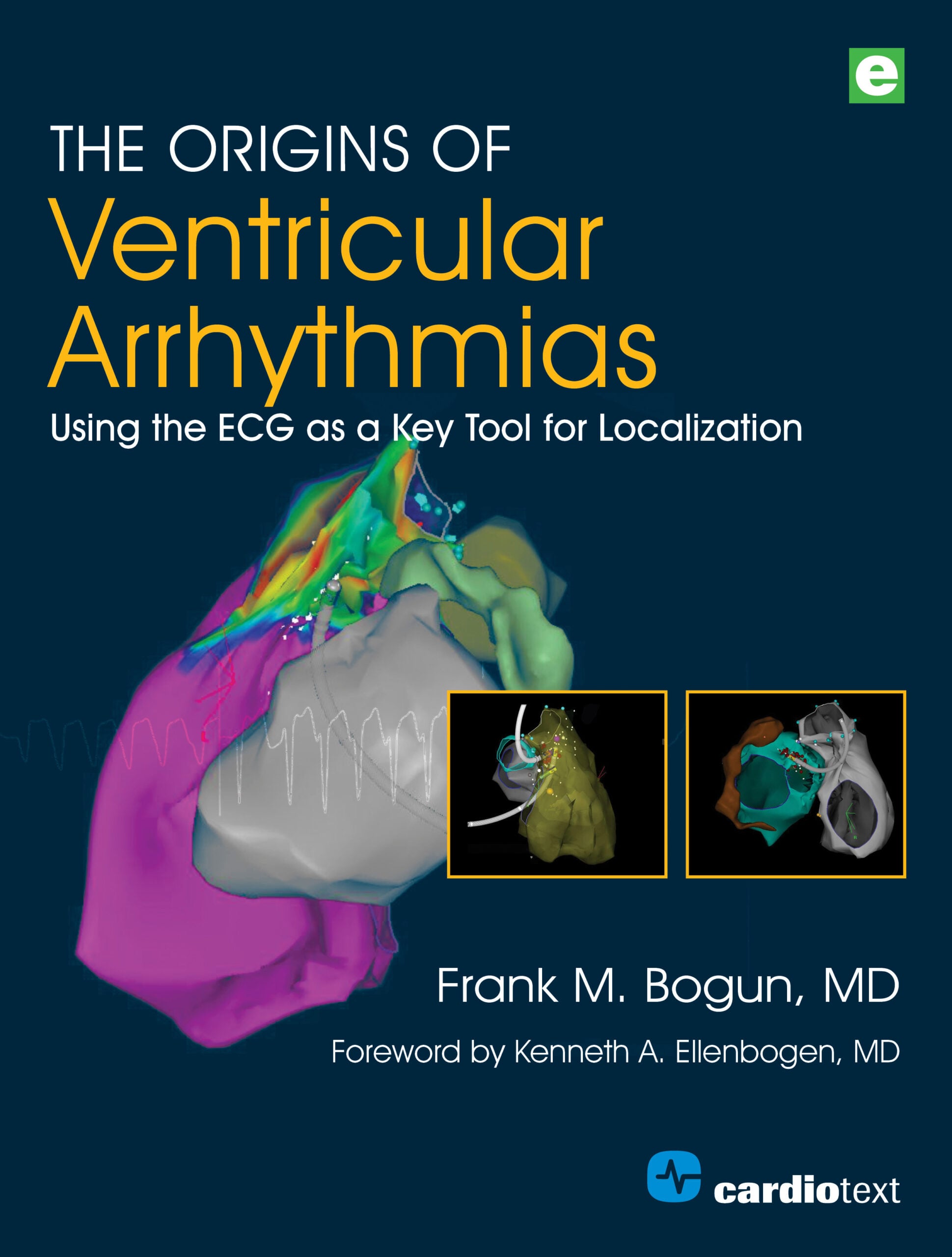 The Origins of Ventricular Arrhythmias: Using the ECG as a Key Tool for Localization (EPUB)