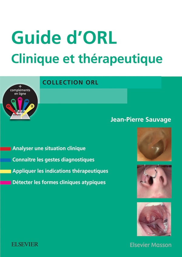 Guide d'ORL: Clinique et thérapeutique (EPUB)