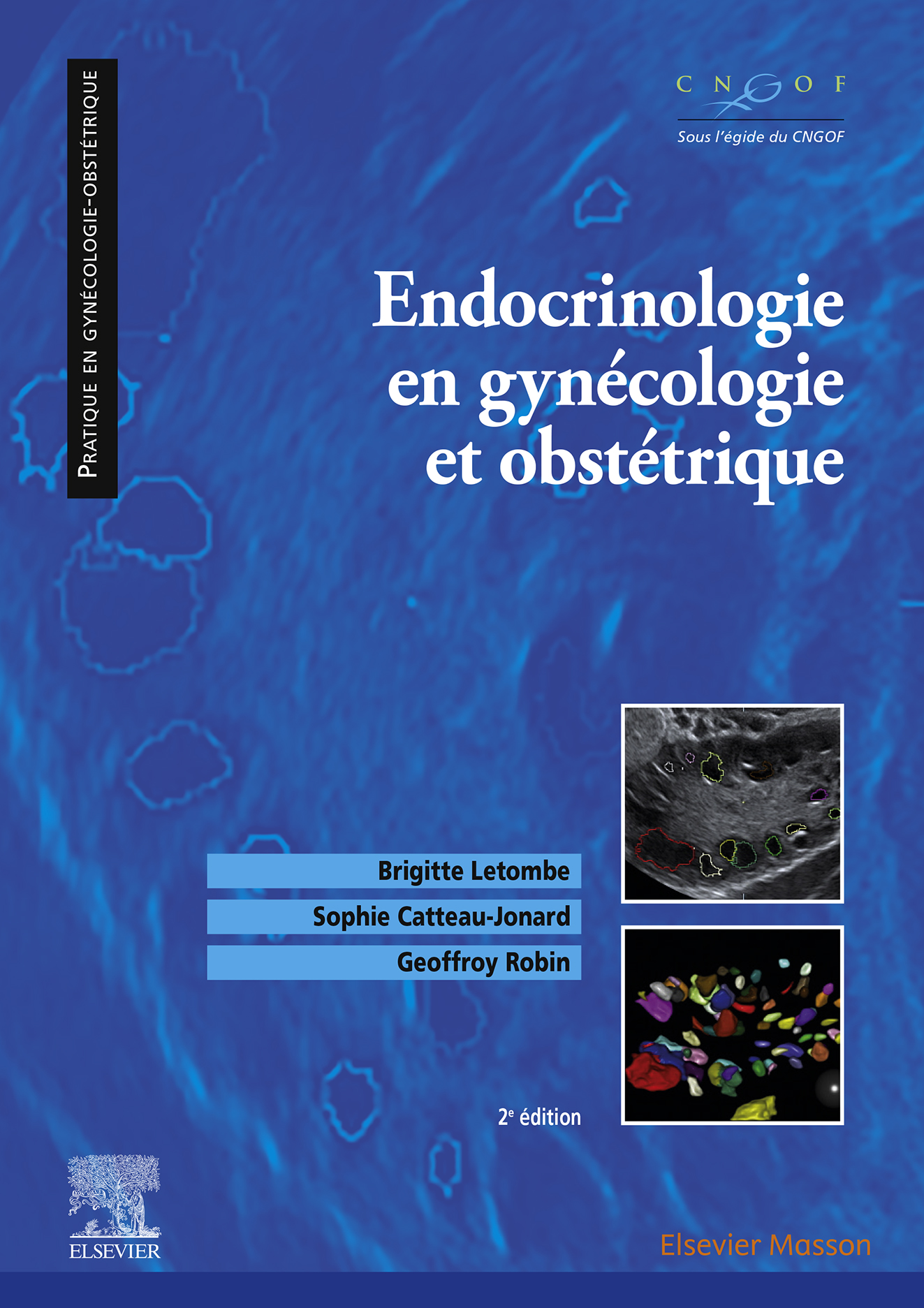 Endocrinologie en gynécologie et obstétrique, 2nd Edition (EPUB)