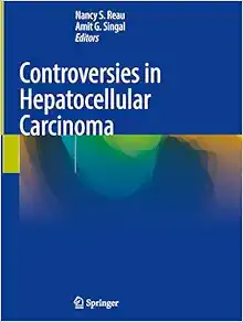 Controversies in Hepatocellular Carcinoma (Original PDF from Publisher)