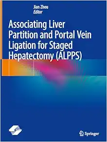 Associating Liver Partition and Portal Vein Ligation for Staged Hepatectomy (ALPPS) (EPUB)