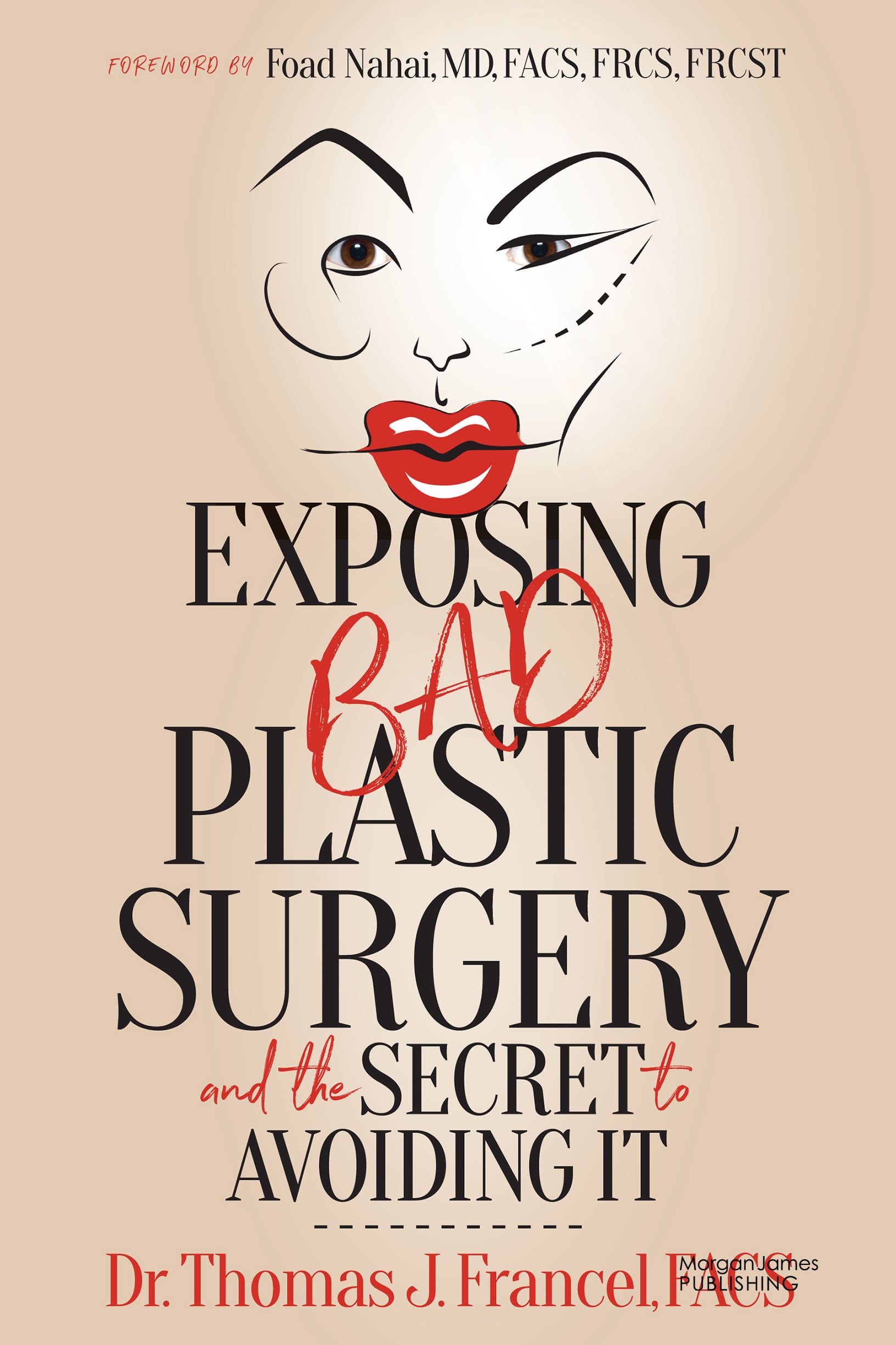 Exposing Bad Plastic Surgery: and the Secret to Avoiding It (EPUB)