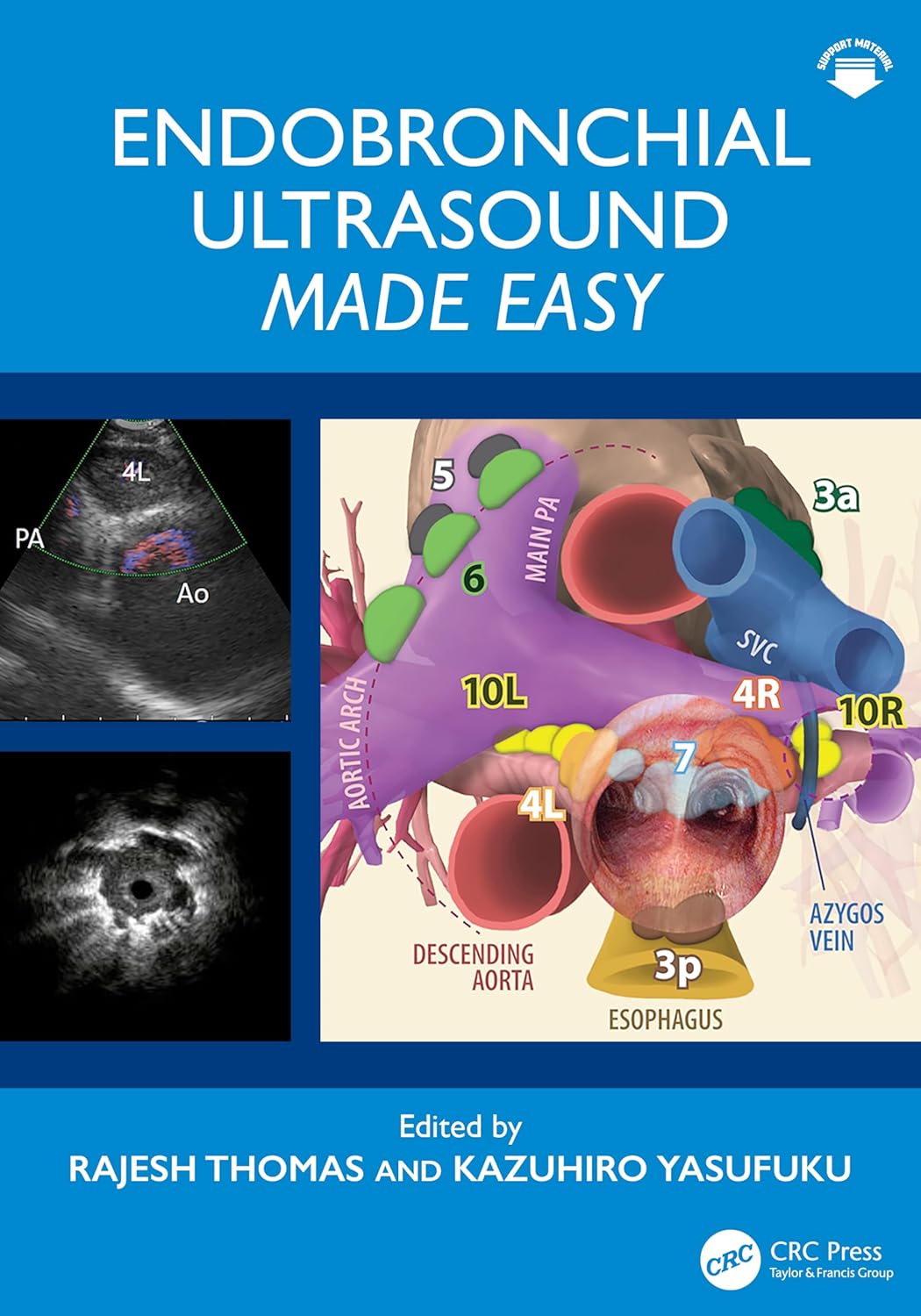 Endobronchial Ultrasound Made Easy (EPUB)