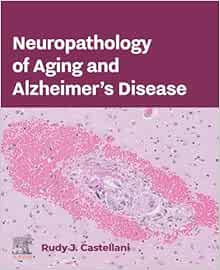 Neuropathology of Aging and Alzheimer's Disease (True PDF from Publisher)
