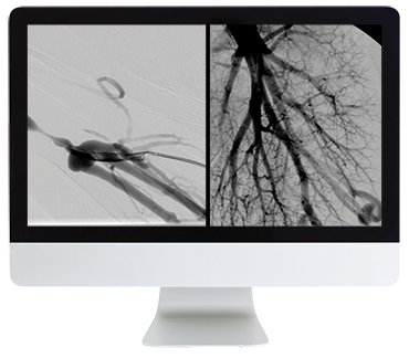 ARRS Case Review of Vascular and Interventional Radiology 2023 (Videos)