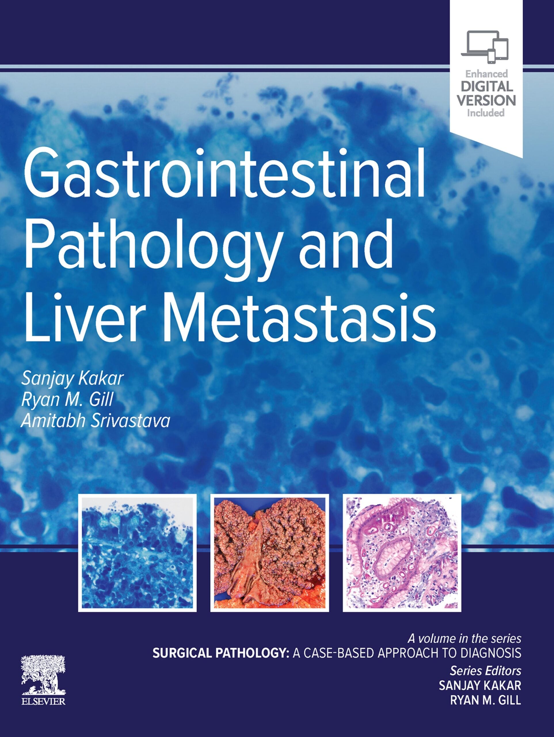 Gastrointestinal Pathology and Liver Metastasis: A Case-Based Approach to Diagnosis (True PDF)