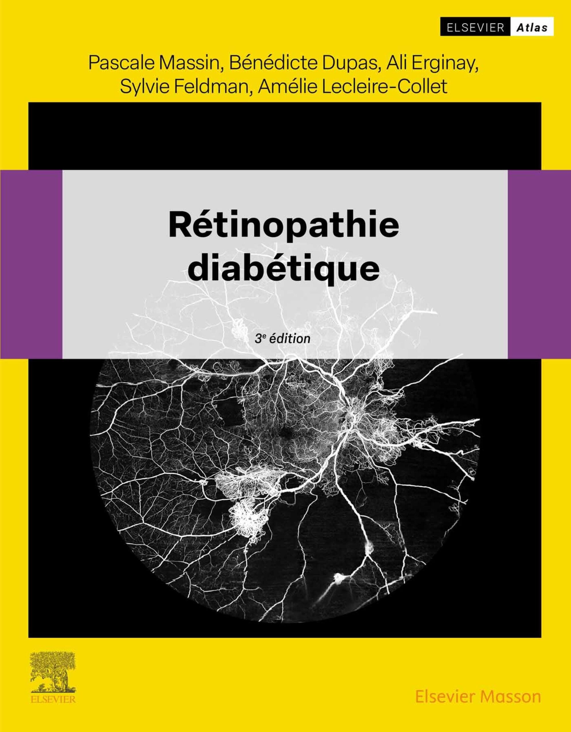 Rétinopathie diabétique, 3rd Edition (EPUB)