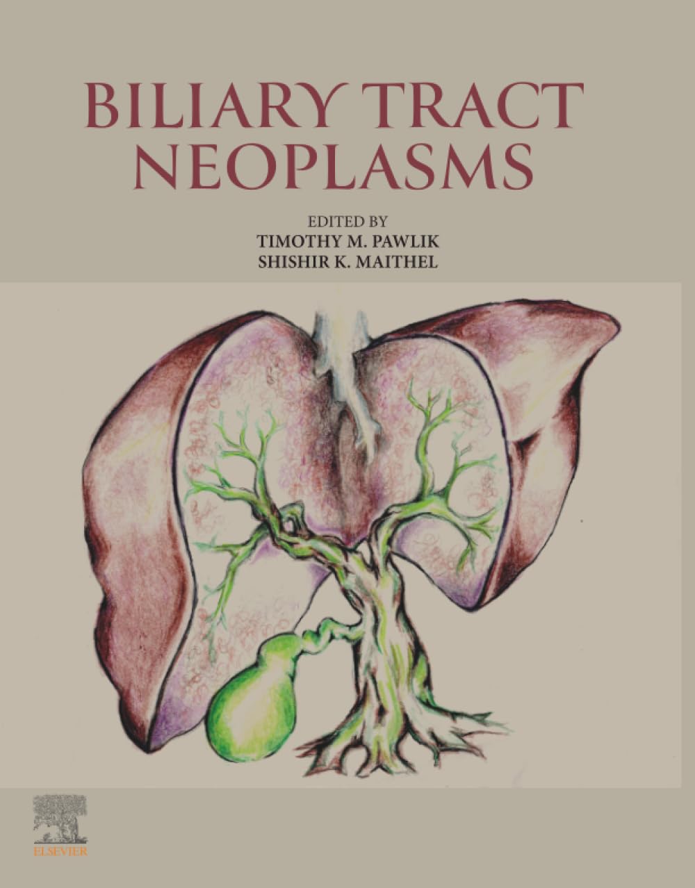 Biliary Tract Neoplasms (True PDF from Publisher)