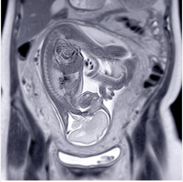 UCSF ObGyn Women's Imaging 2025 (Videos + Slides PDFs)