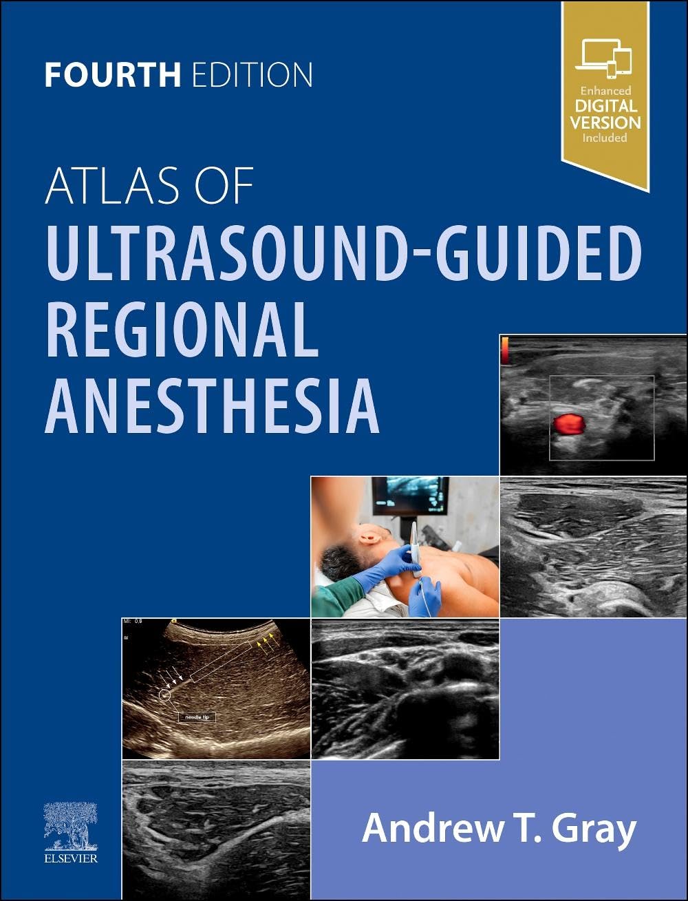 Atlas of Ultrasound-Guided Regional Anesthesia, 4th Edition (EPUB)