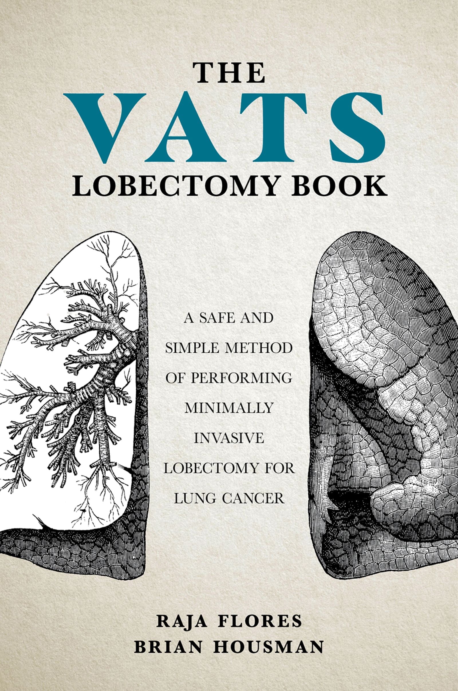 The VATS Lobectomy Book (EPUB)