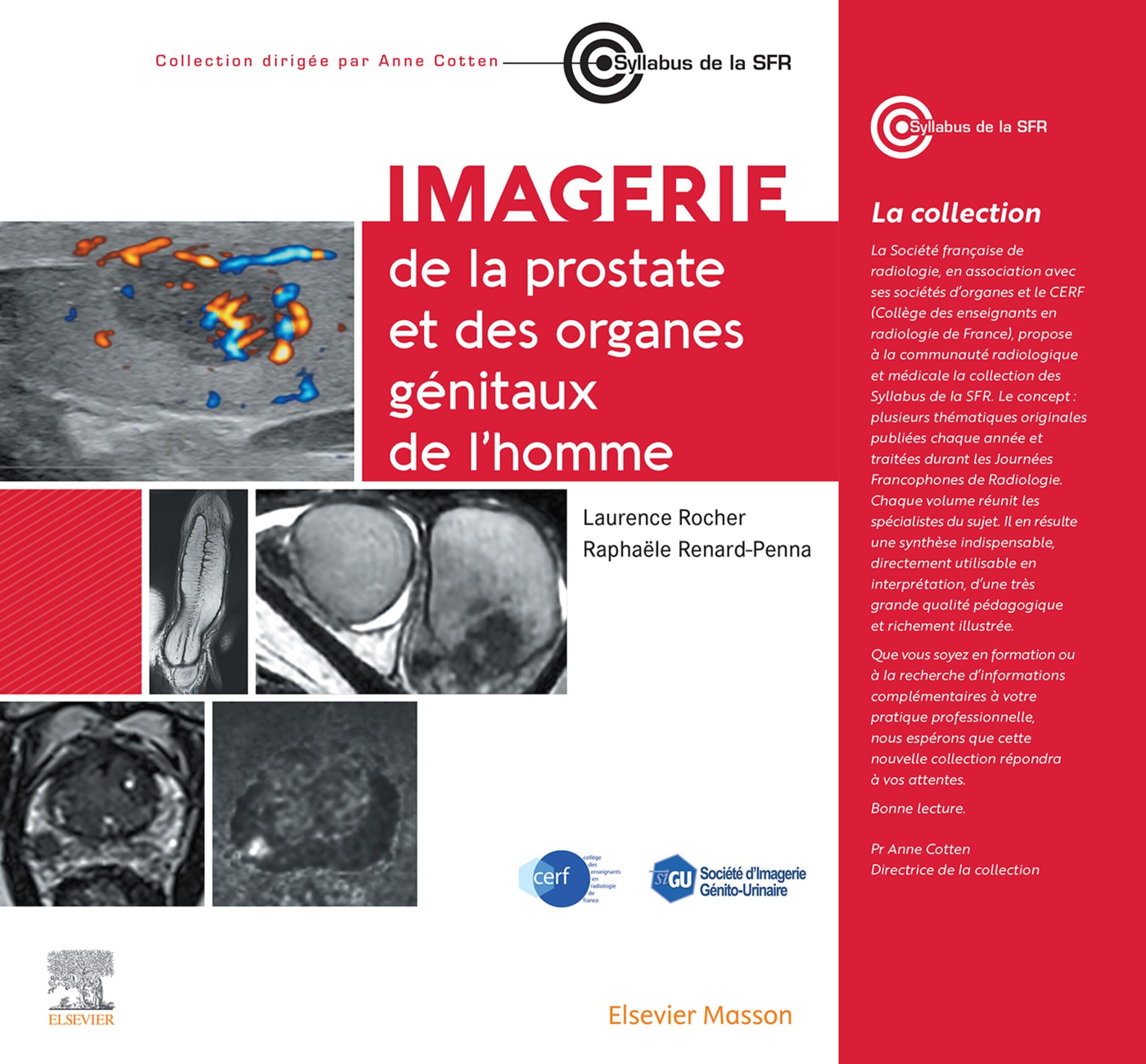 Imagerie de la prostate et des organes génitaux de l'homme (Original PDF from Publisher)