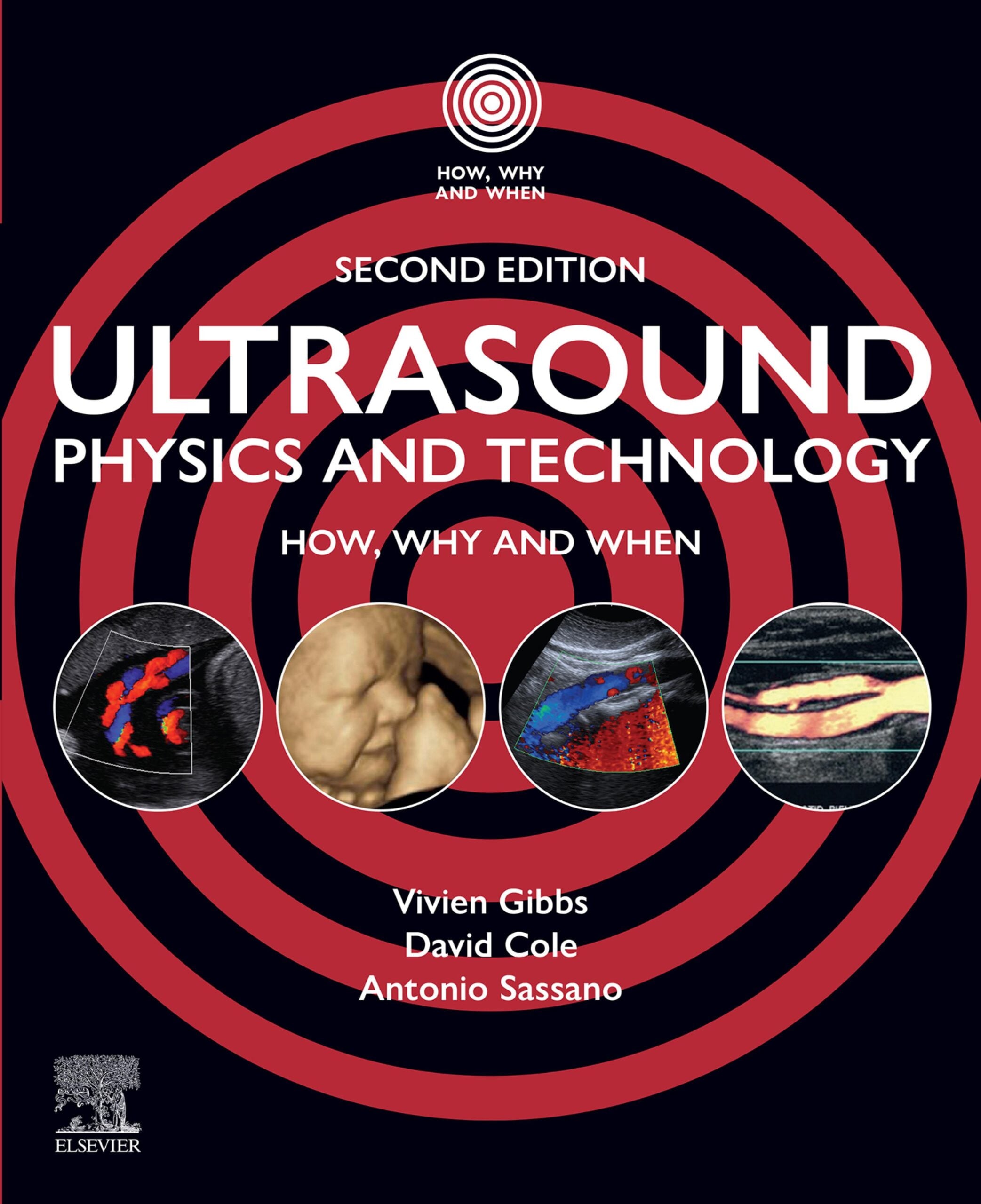 Ultrasound Physics and Technology, 2nd Edition (EPUB)