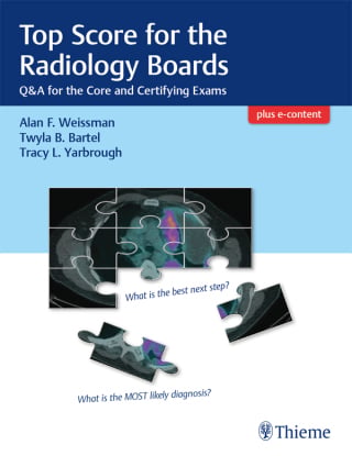 Top Score for the Radiology Boards (EPUB)