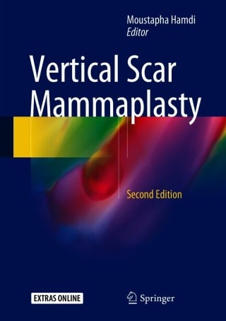Vertical Scar Mammaplasty, 2nd Edition (Original PDF from Publisher)