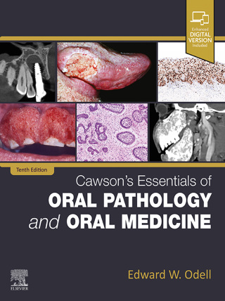 Cawson's Essentials of Oral Pathology and Oral Medicine, 10th Edition (Original PDF from Publisher)