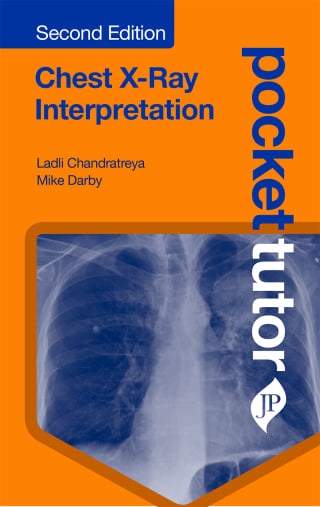 Pocket Tutor: Chest X-Ray Interpretation, 2nd Edition (Original PDF from Publisher)