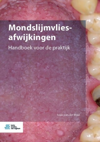 Mondslijmvliesafwijkingen (EPUB)