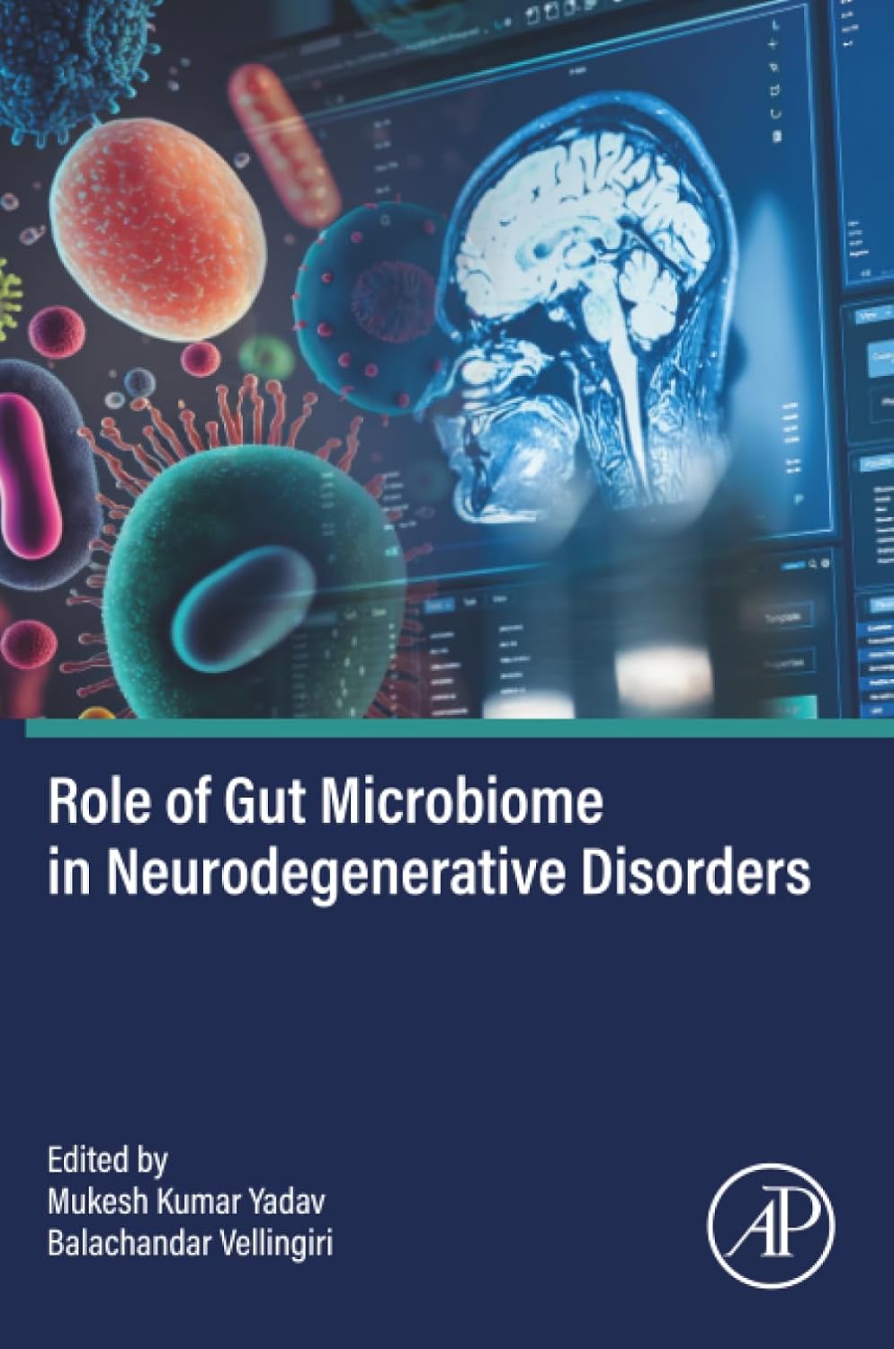 Role of Gut Microbiome in Neurodegenerative Disorders (Original PDF from Publisher)