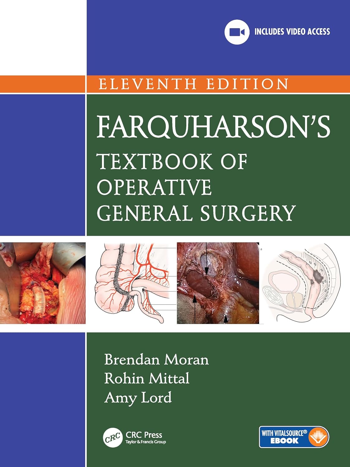 Farquharson's Textbook of Operative General Surgery, 11th Edition (EPUB)