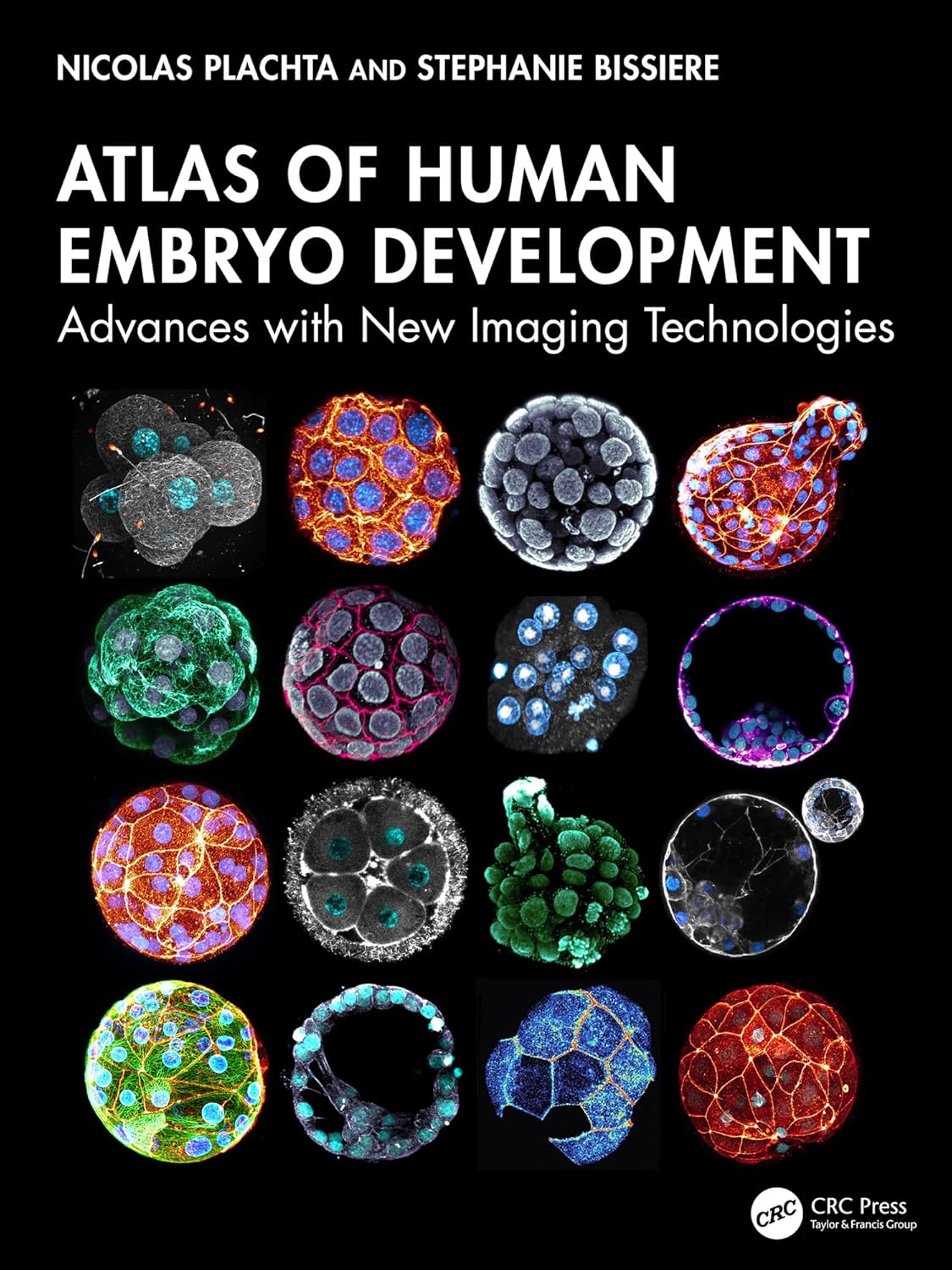 Atlas of Human Embryo Development: Advances with New Imaging Technologies (Original PDF from Publisher)