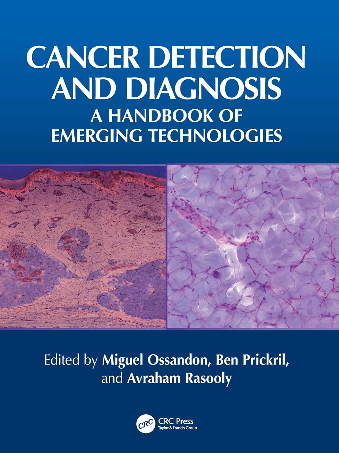 Cancer Detection and Diagnosis: A Handbook of Emerging Technologies (EPUB)