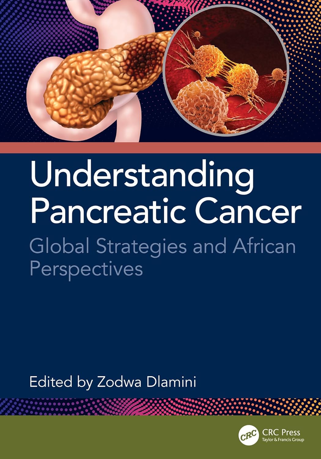 Understanding Pancreatic Cancer: Global Strategies and African Perspectives (Original PDF from Publisher)