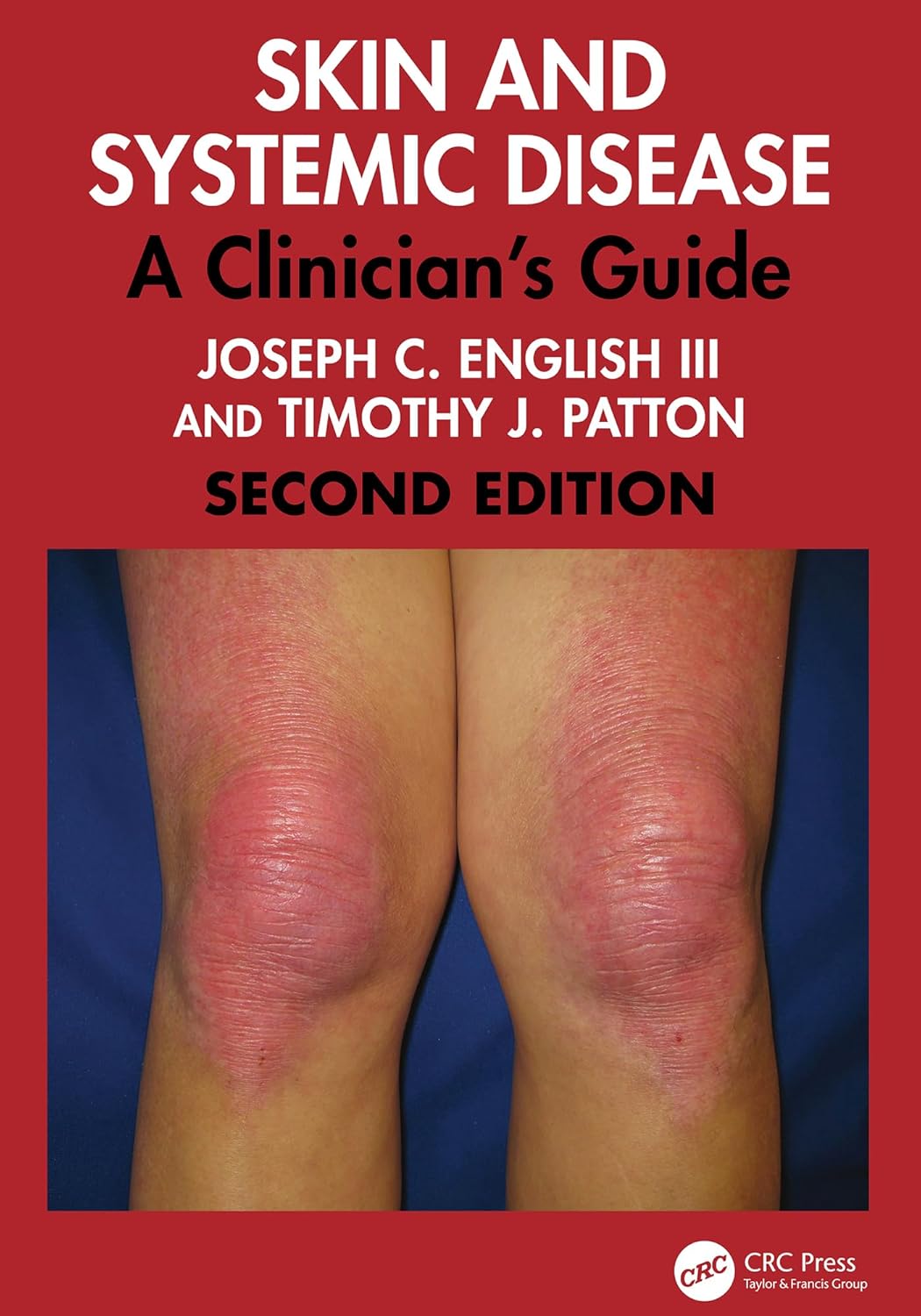 Skin and Systemic Disease: A Clinician's Guide, 2nd Edition (EPUB)