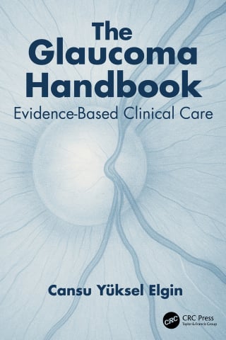 The Glaucoma Handbook (EPUB)