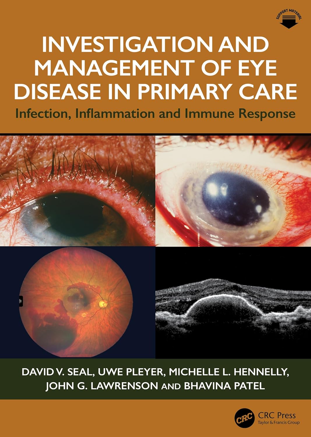 Investigation & Management of Eye Disease in Primary Care: Infection, Inflammation and Immune Response (EPUB)