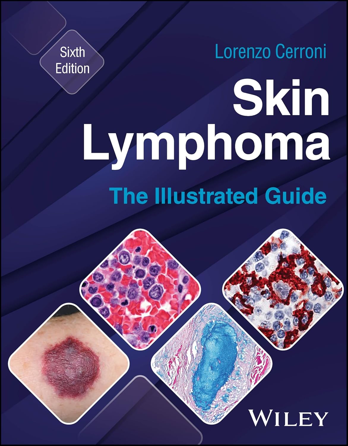 Skin Lymphoma: The Illustrated Guide, 6th Edition (EPUB)