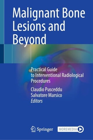 Malignant Bone Lesions and Beyond (EPUB)