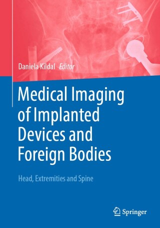Medical Imaging of Implanted Devices and Foreign Bodies, 2024th Edition (EPUB)