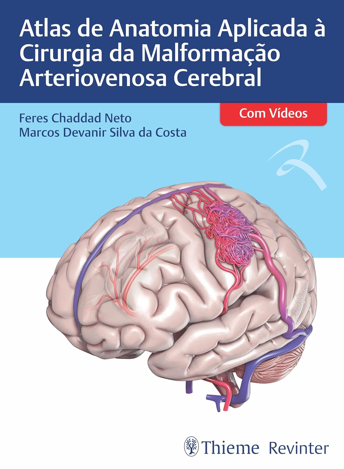 Atlas De Anatomia Aplicada À Cirurgia Da Malformação Arteriovenosa Cerebral (Portuguese Edition) (EPUB)
