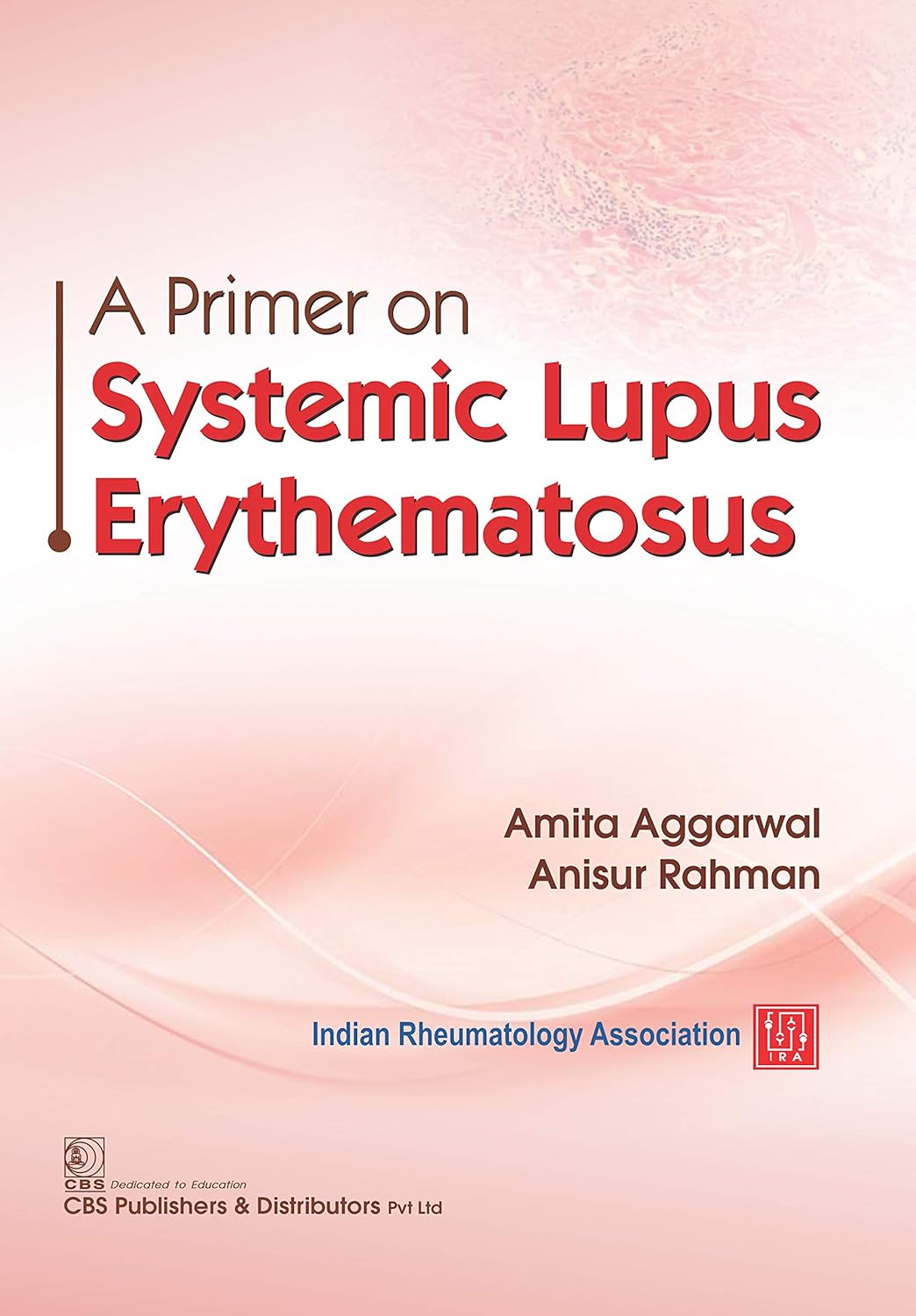 A Primer on Lupus Systematic Erythematosus (Original PDF from Publisher)