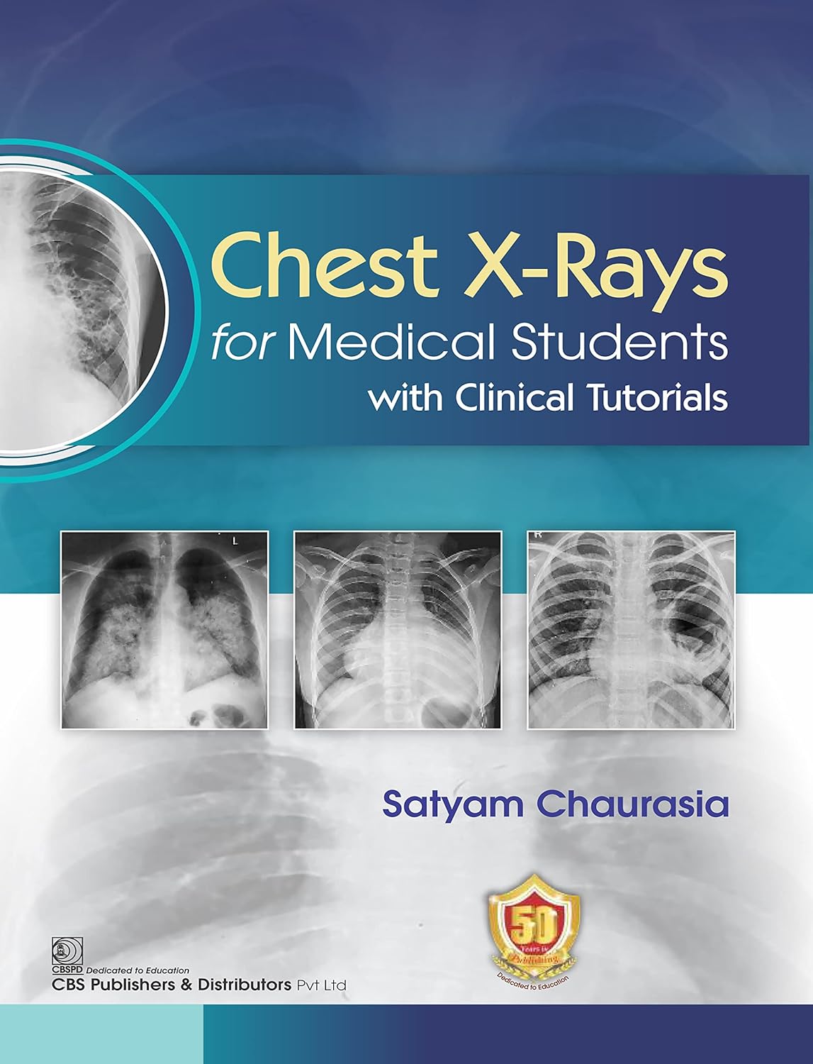Chest X-ray for Medical Students with Clinical Tutorials (Original PDF from Publisher)