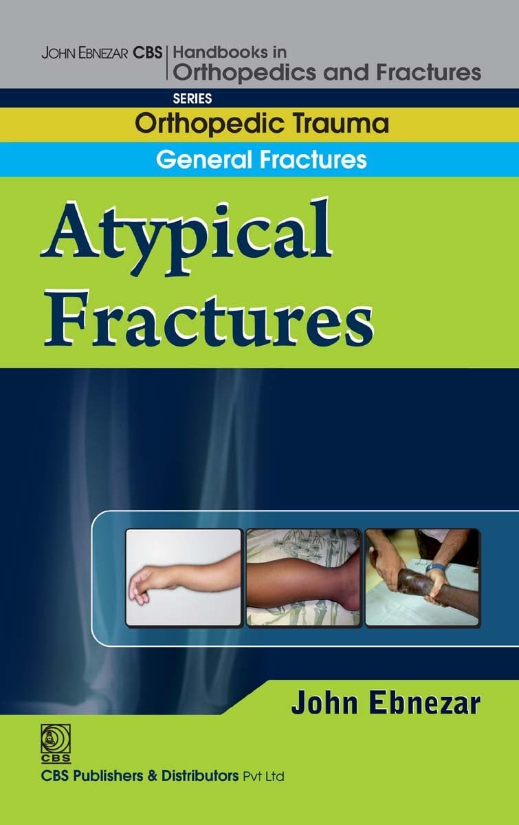 Atypical Fractures (EPUB)