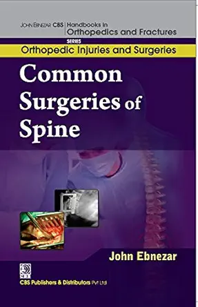 Common Surgeries of Spine (EPUB)