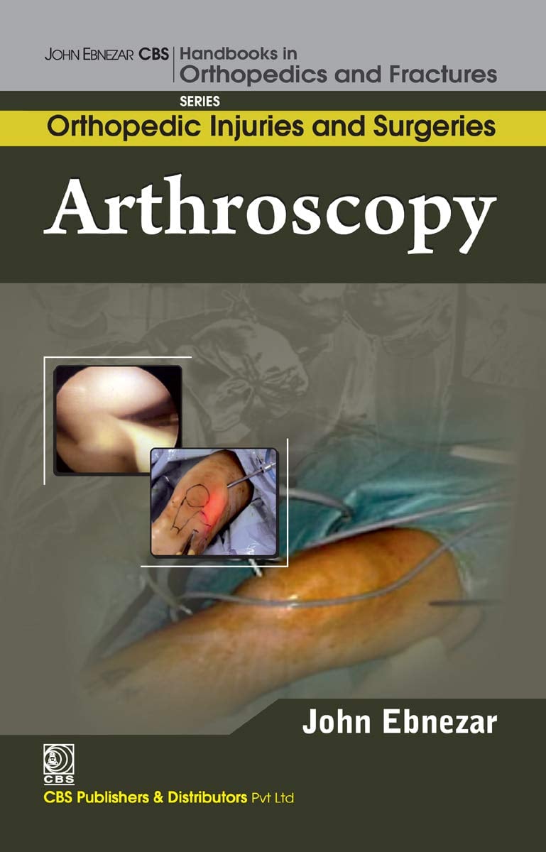 Arthroscopy (EPUB)