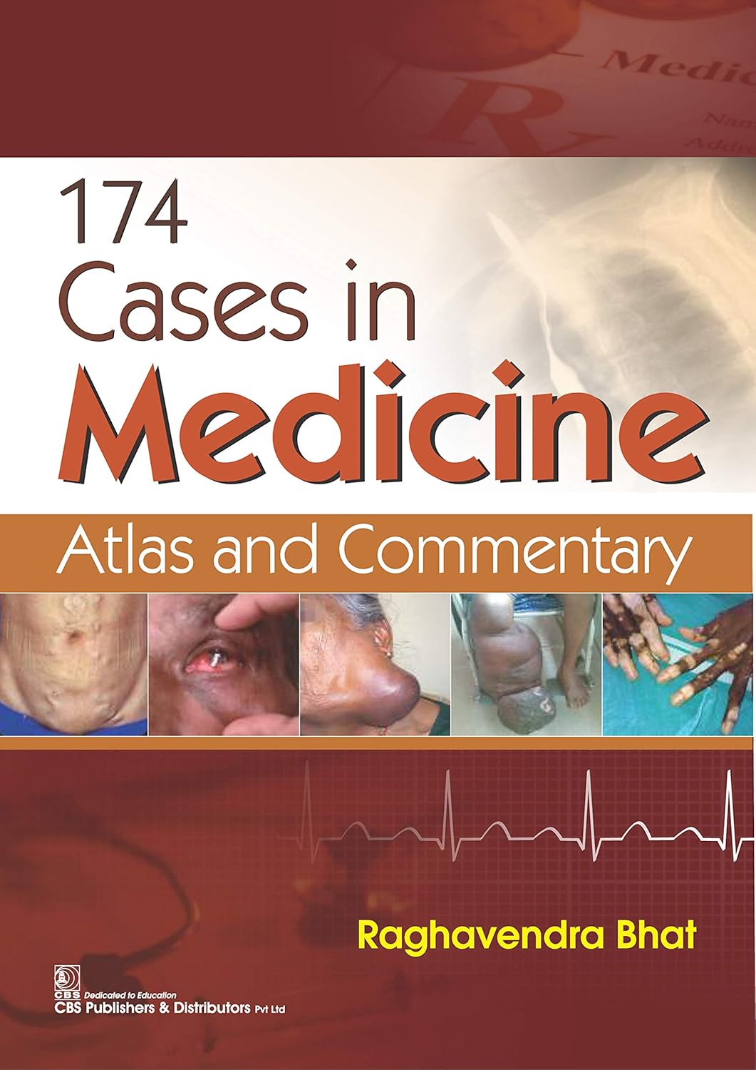 174 cases in Medicine (Original PDF from Publisher)