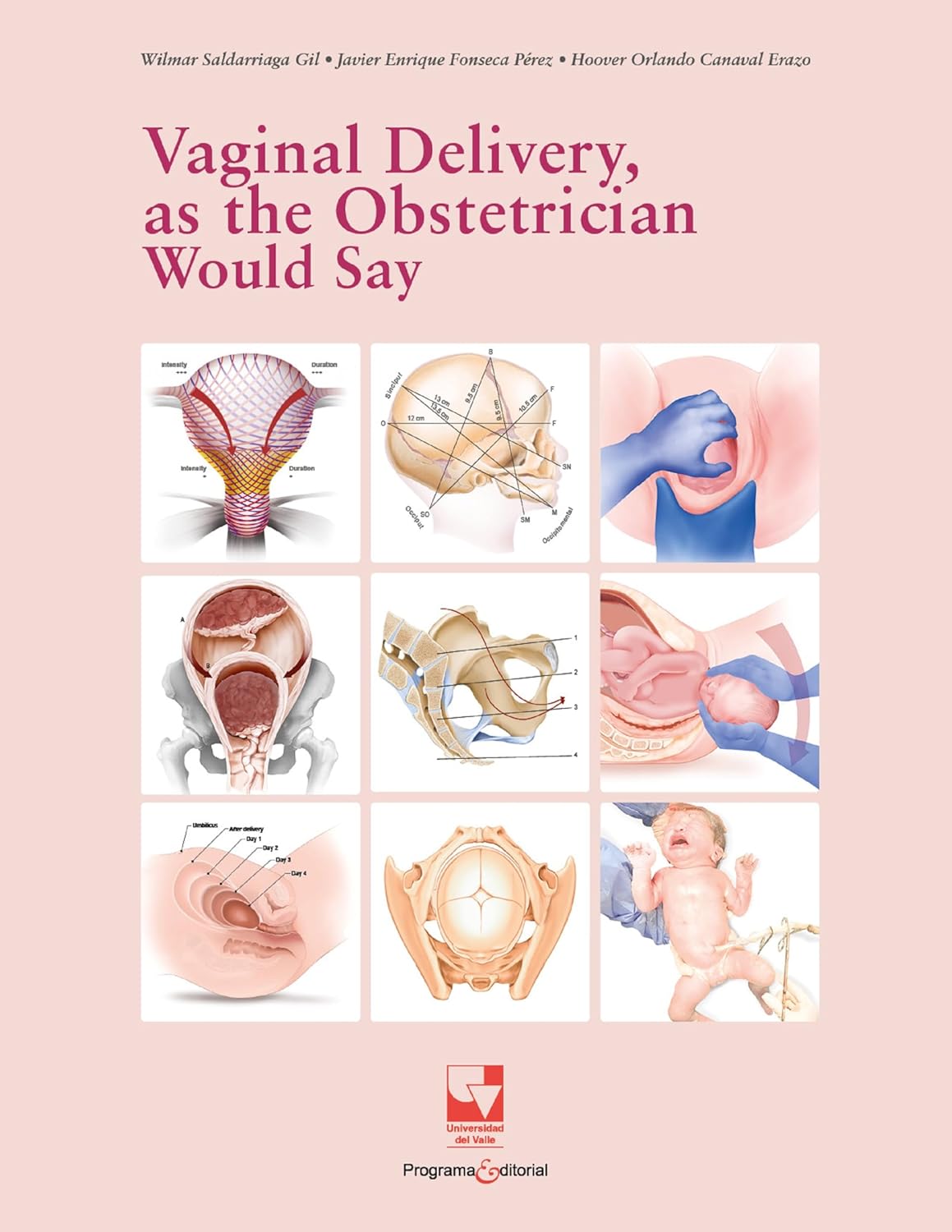 Vaginal Delivery, as the Obstetrician Would Say (Spanish Edition) (Original PDF from Publisher)