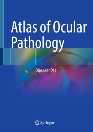 Atlas of Ocular Pathology (Original PDF from Publisher)