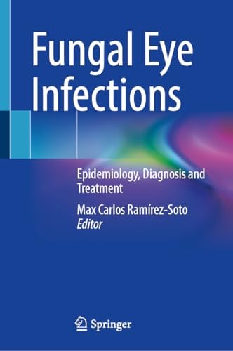 Fungal Eye Infections: Epidemiology, Diagnosis and Treatment (Original PDF from Publisher)