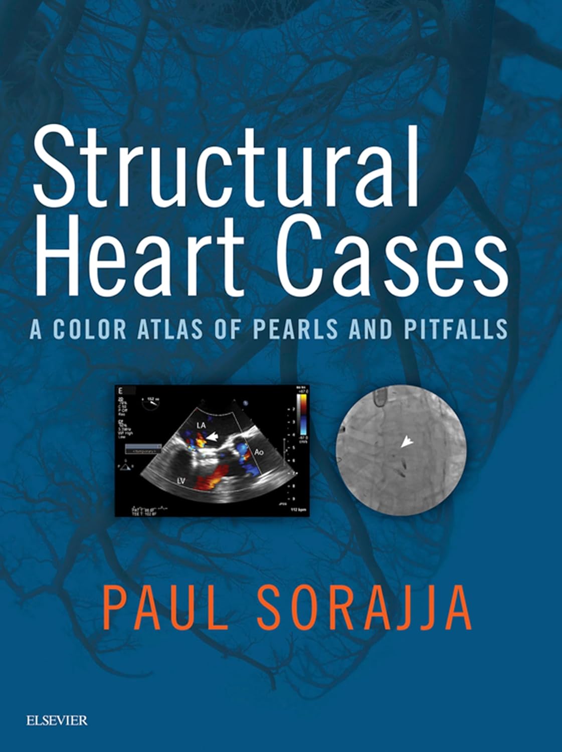 Structural Heart Cases: A Color Atlas of Pearls and Pitfalls (EPUB)