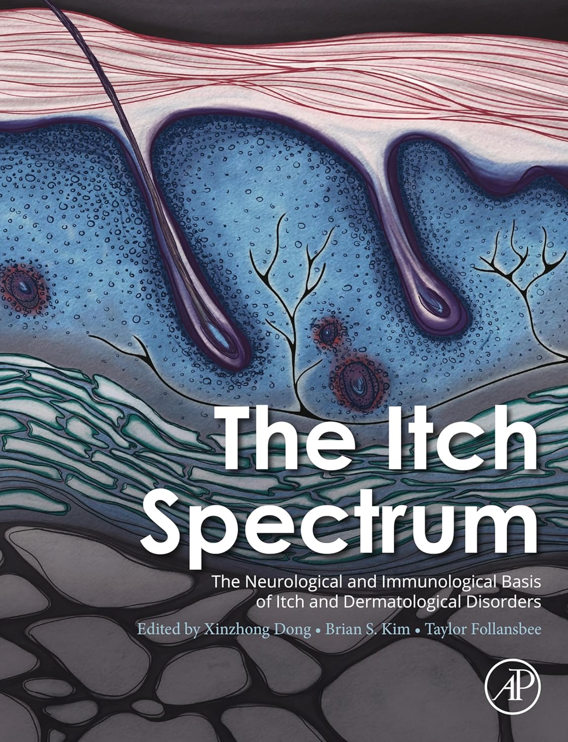 The Itch Spectrum (Original PDF from Publisher)