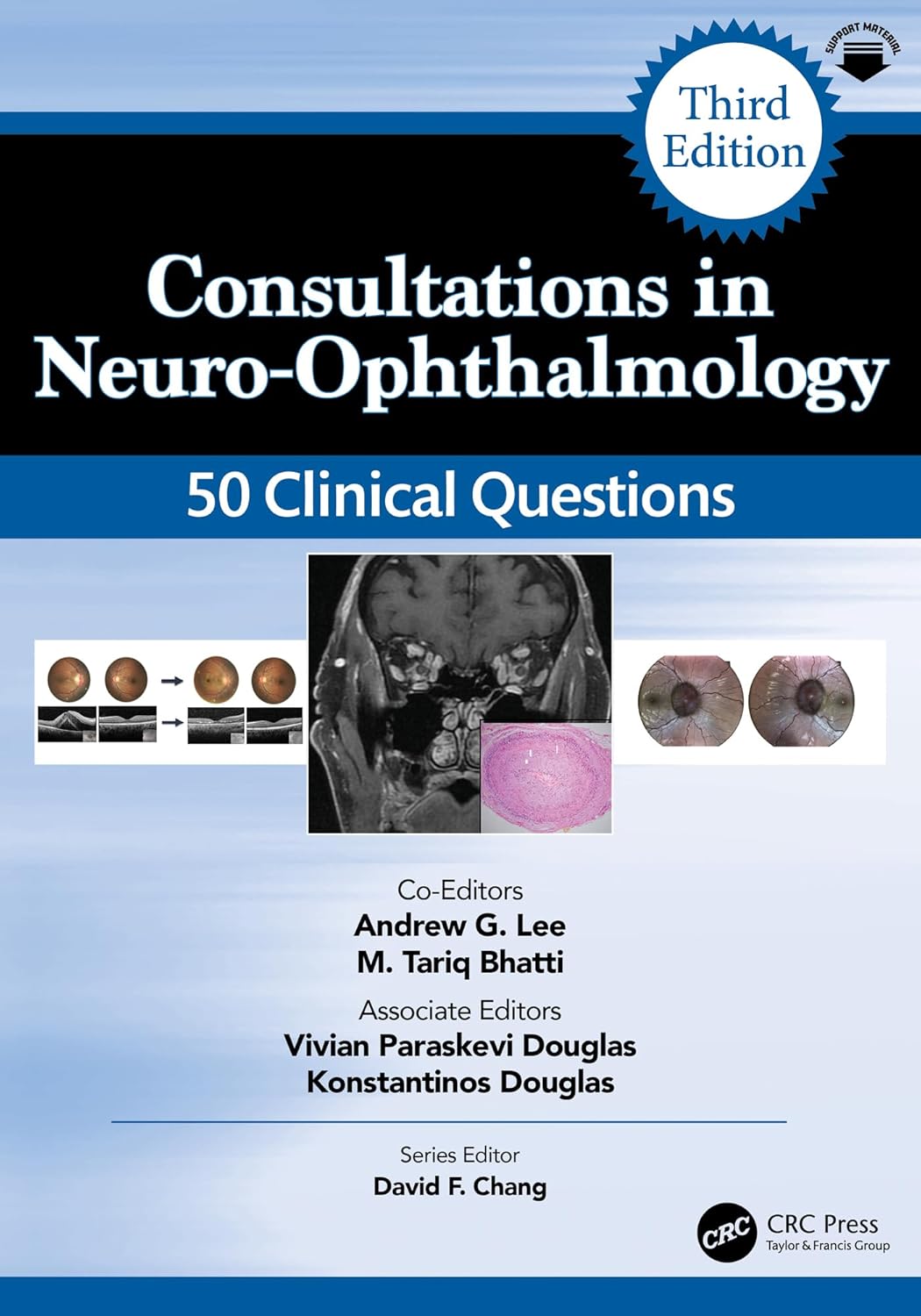 Consultations in Neuro-Ophthalmology: 50 Clinical Questions (Curbside Consultation in Ophthalmology), 3rd Edition (EPUB)