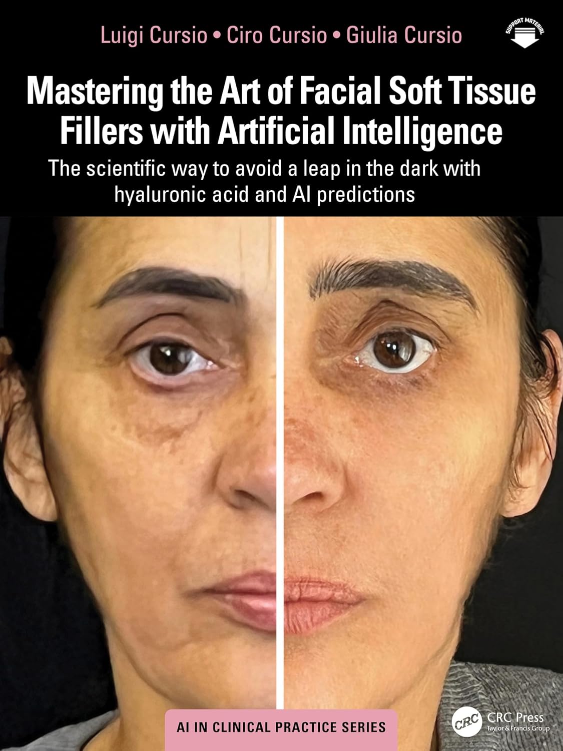 Mastering the Art of Facial Soft Tissue Fillers with Artificial Intelligence: The scientific way to avoid a leap in the dark with hyaluronic acid and AI predictions (AI in Clinical Practice) (EPUB)