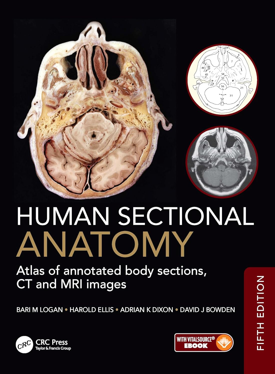 Human Sectional Anatomy: Atlas of annotated body sections, CT and MRI images, 5th Edition (EPUB)