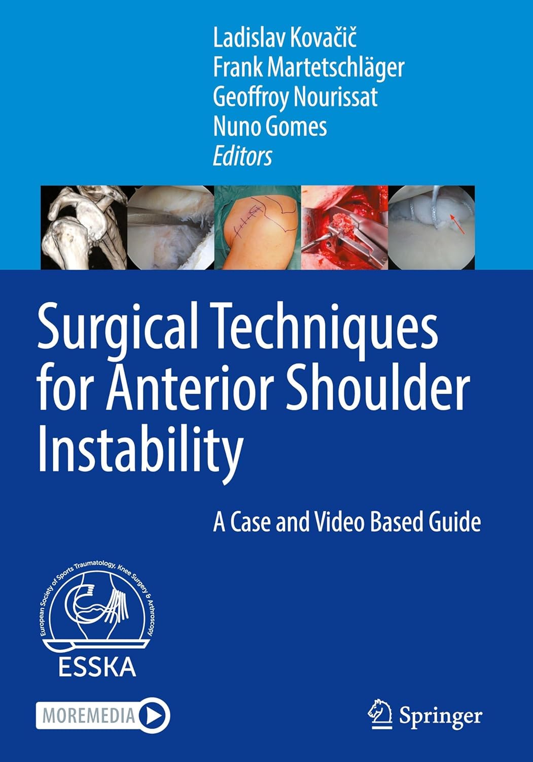 Surgical Techniques for Anterior Shoulder Instability: A Case and Video Based Guide (EPUB)